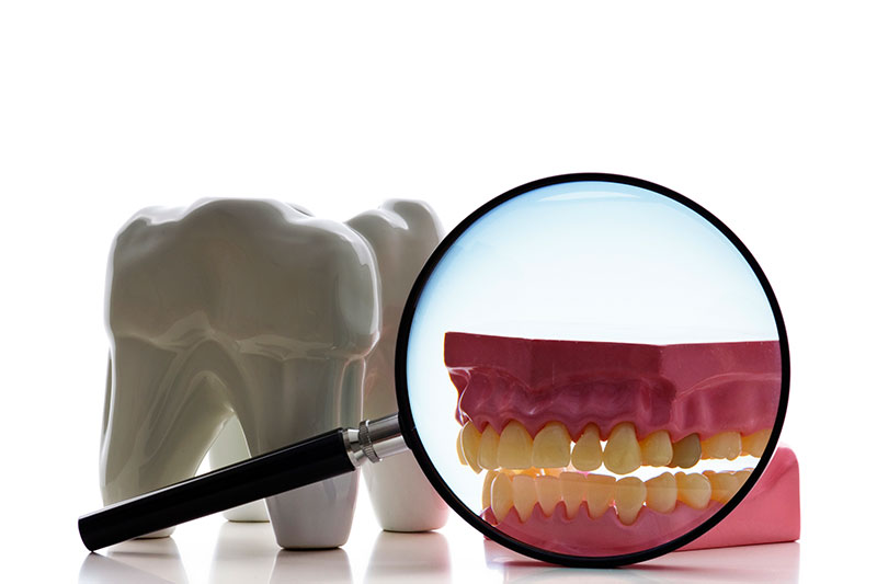 Root Canal Treatment in Great Neck
