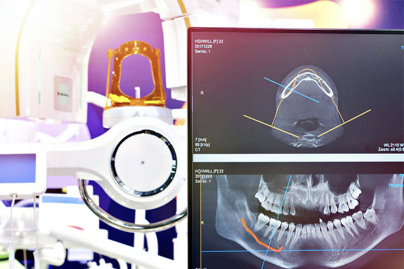 Digital X-Rays in Great Neck