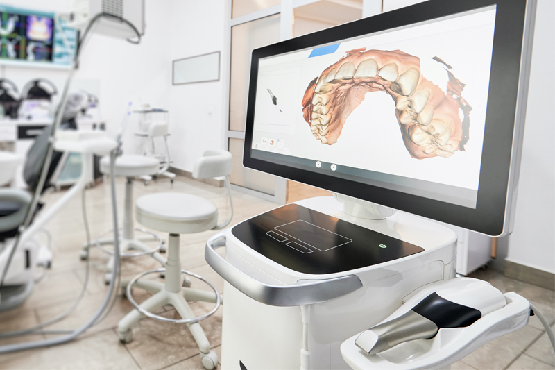 Intra-Oral Scanner in Great Neck
